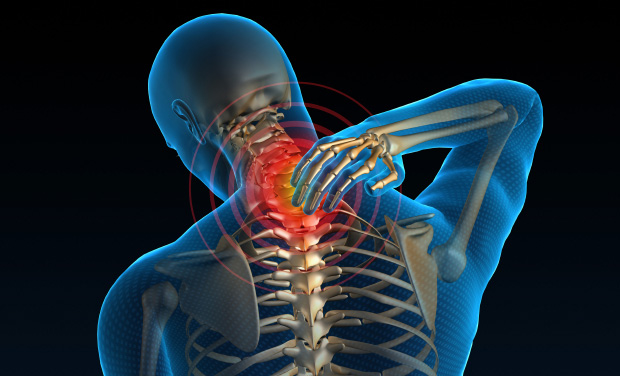 Neck Pain And The Rest Of The Symptoms The Bodyworks Clinic